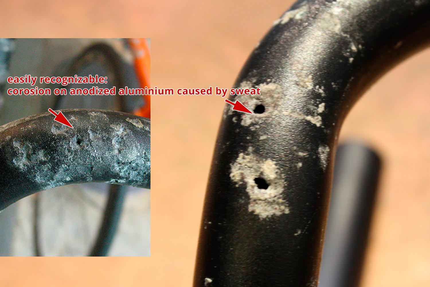Corrosion on anodized aluminium caused by human sweat